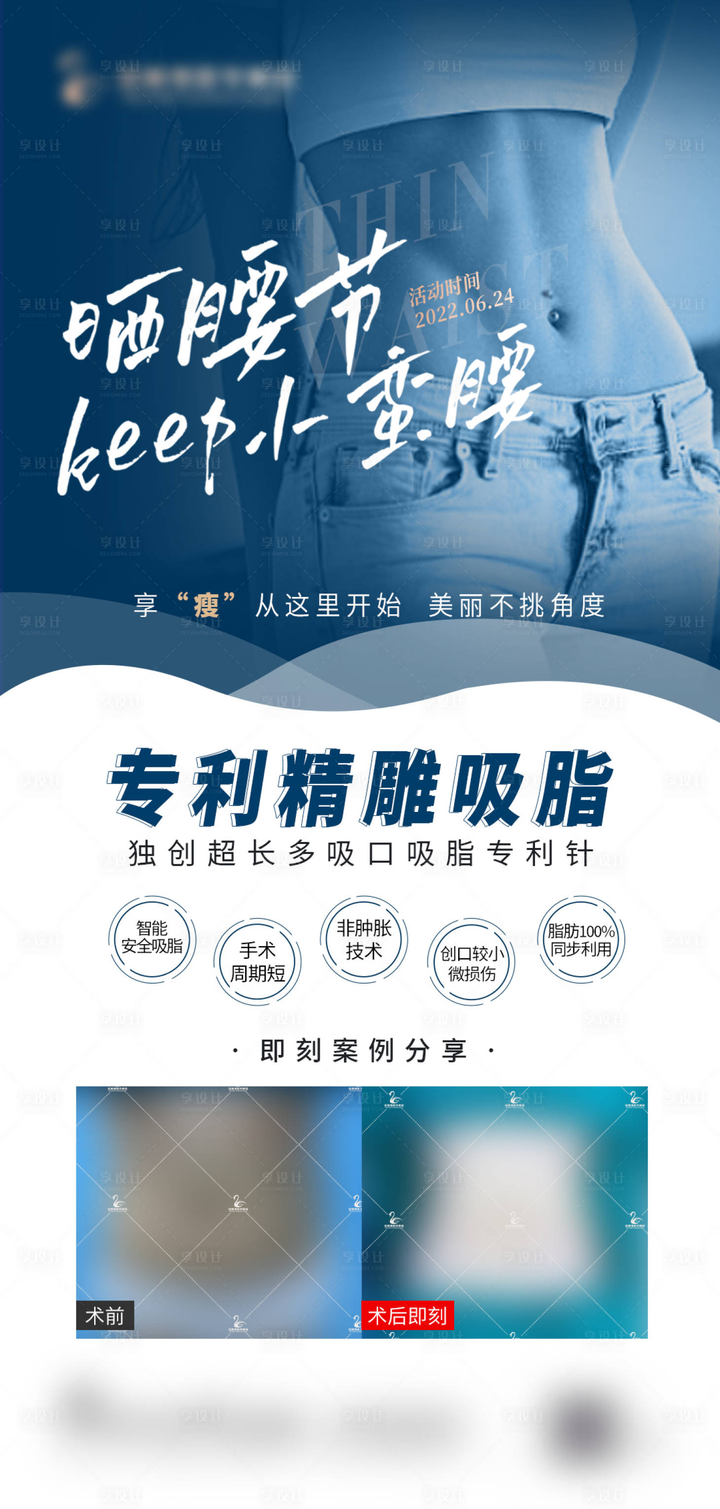 源文件下載【享設計】搜索編號：35920010670769913【醫美整形吸脂海報】