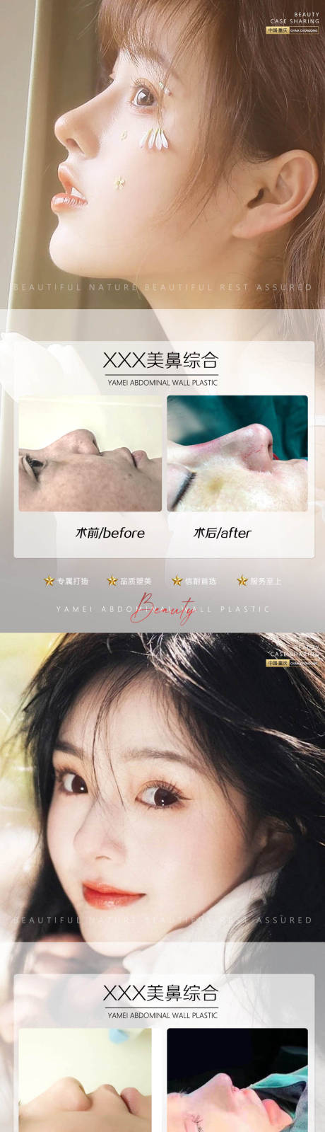 源文件下載【享設(shè)計(jì)】搜索編號(hào)：10490010454496299【醫(yī)美案例對(duì)比系列海報(bào)】