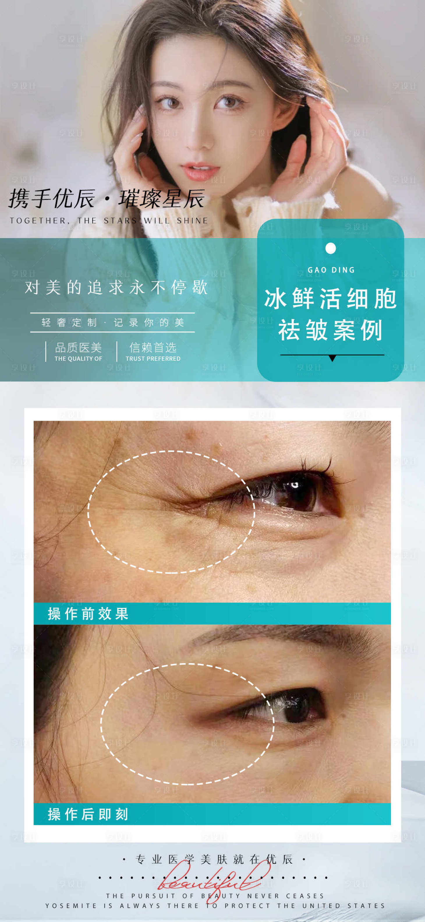 源文件下载【享设计】搜索编号：47910010683762241【医美案例对比人物海报】