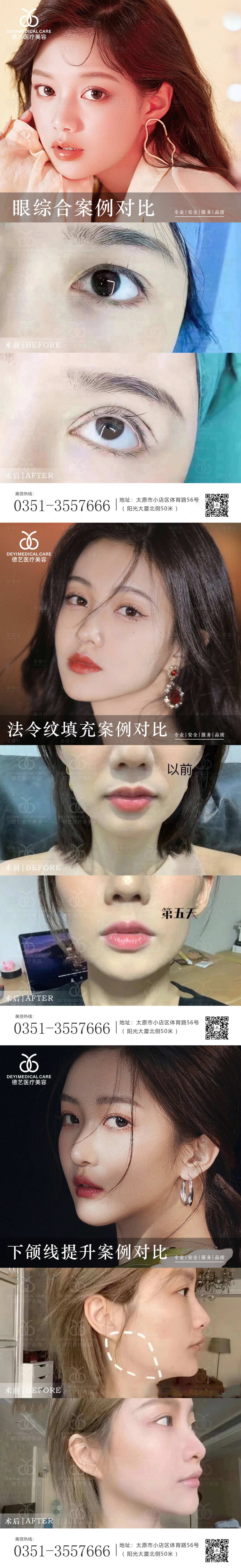 源文件下载【享设计】搜索编号：60750010471501048【医美案例对比填充系列海报】