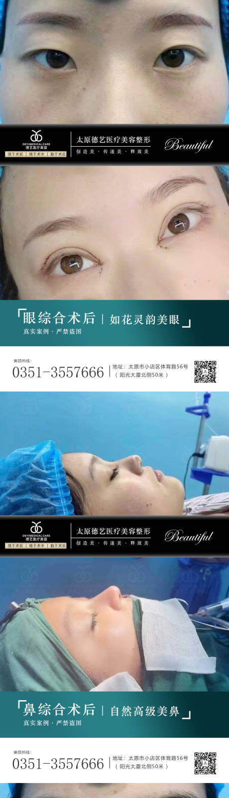 源文件下载【医美案例对比系列海报】编号：18240010525356777