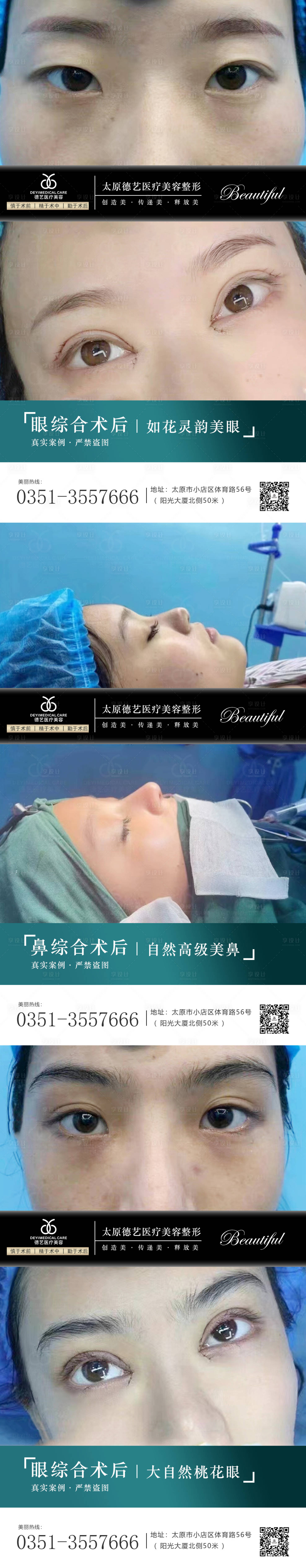 源文件下载【医美案例对比系列海报】编号：18240010525356777