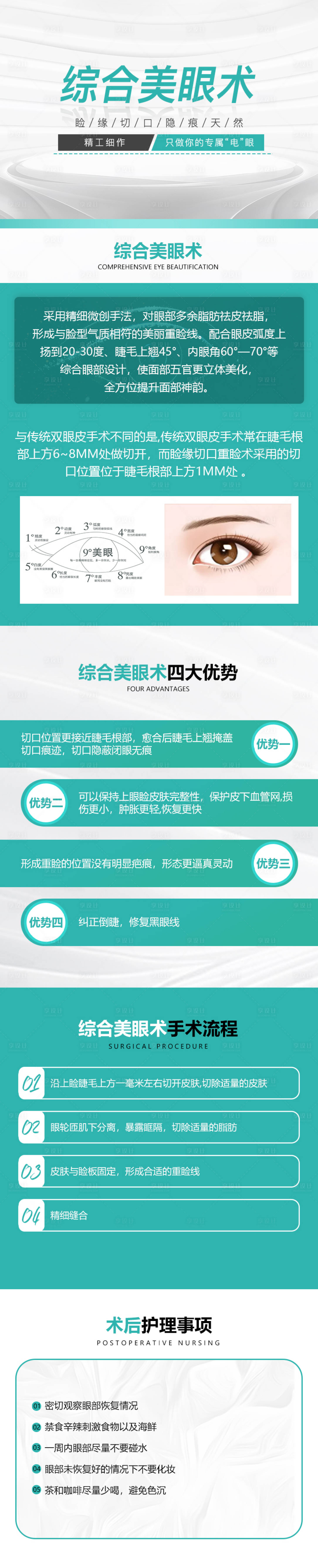 源文件下载【综合美眼术双眼皮详情页】编号：15590010598978624