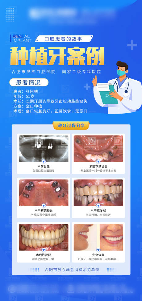 源文件下載【享設計】搜索編號：74470010723238489【55歲阿姨種植牙案例圖】