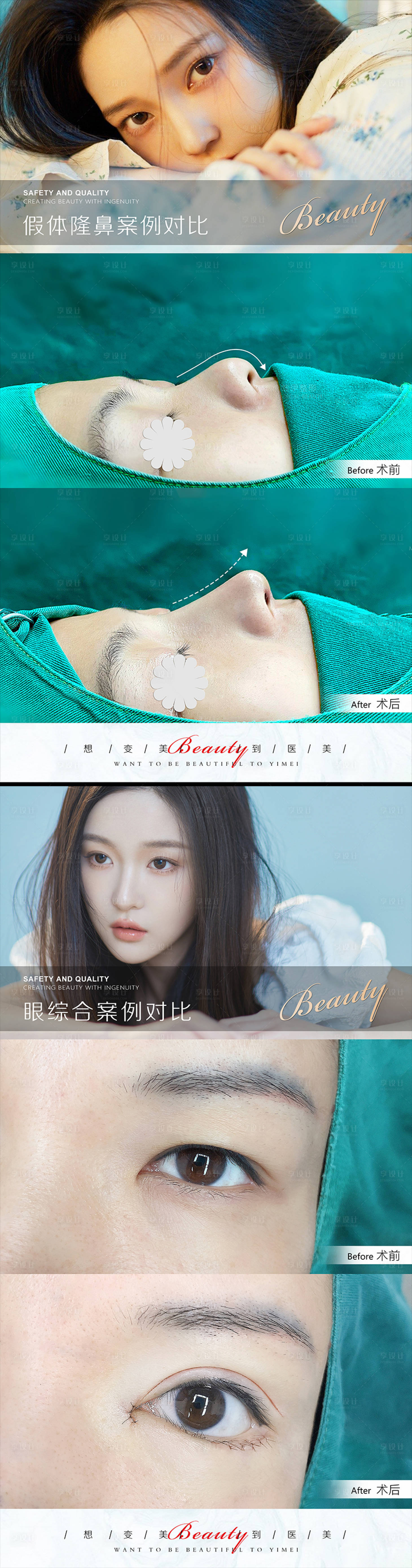 源文件下载【享设计】搜索编号：73600010483301130【医美案例模板】