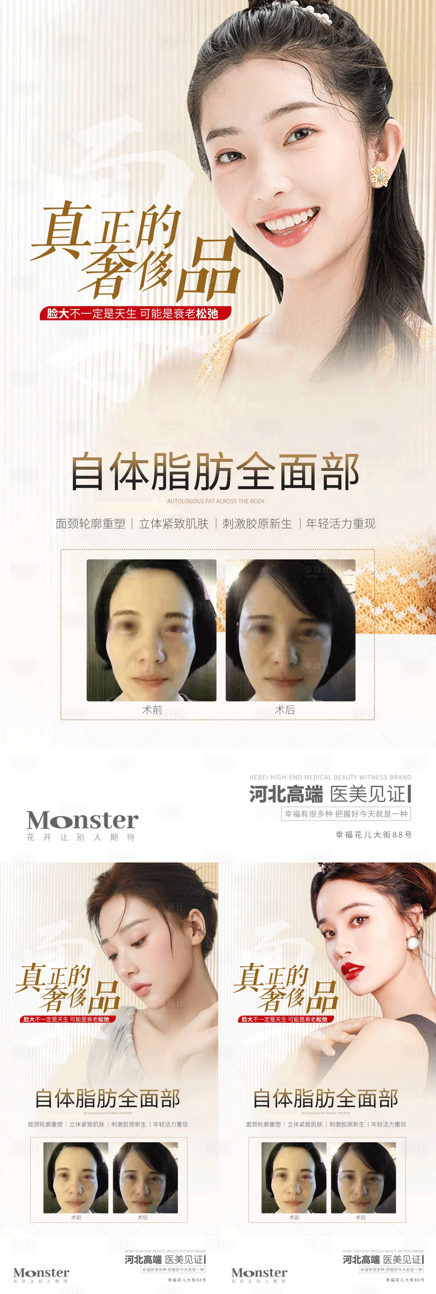 源文件下载【医美自体脂肪案例海报】编号：14640010685871435