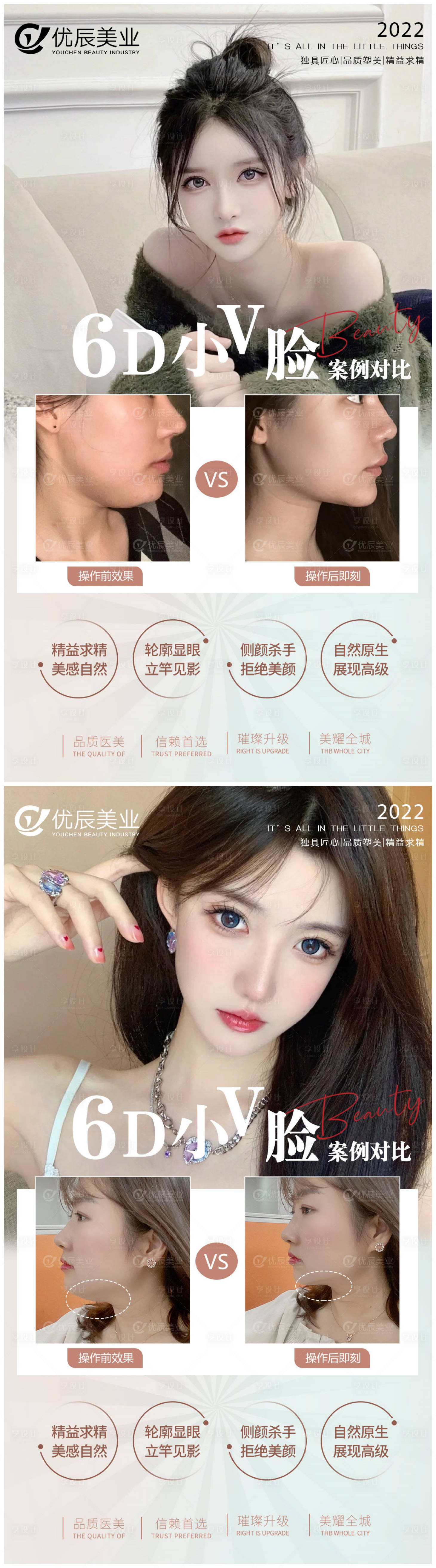 源文件下载【享设计】搜索编号：98410010683235633【医美案例对比图系列海报】