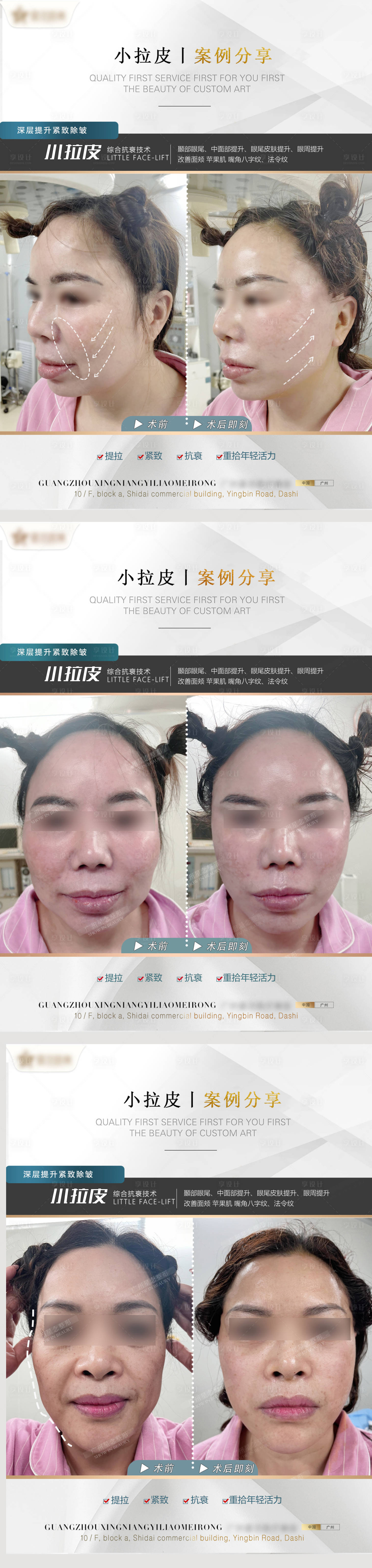 源文件下載【享設計】搜索編號：71420010605004136【醫美小拉皮案例系列海報】