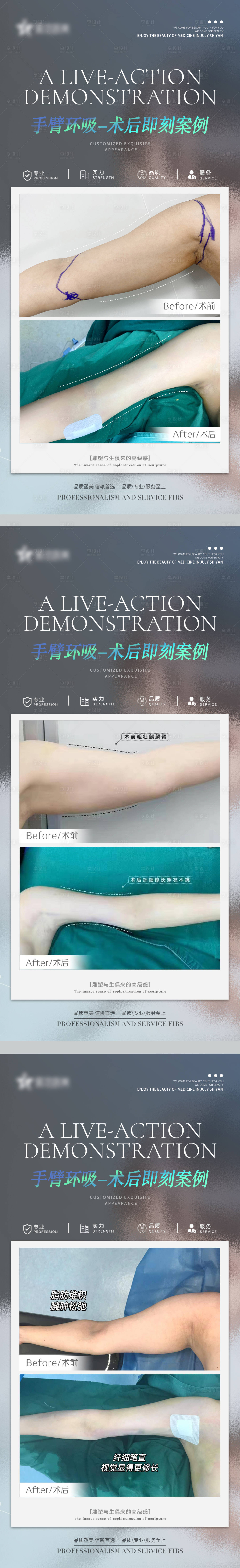 源文件下载【享设计】搜索编号：84940010612787620【手臂环吸案例】