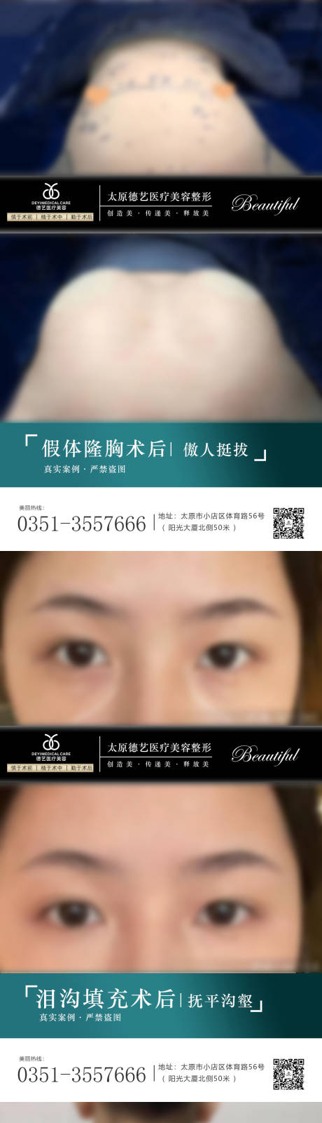 源文件下载【医美案例对比图】编号：30330010540999563