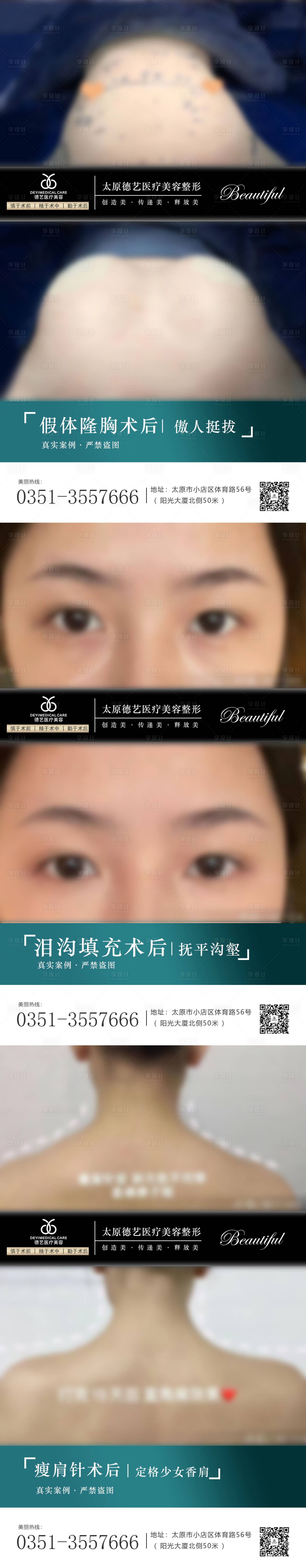 源文件下載【享設計】搜索編號：30330010540999563【醫(yī)美案例對比圖】