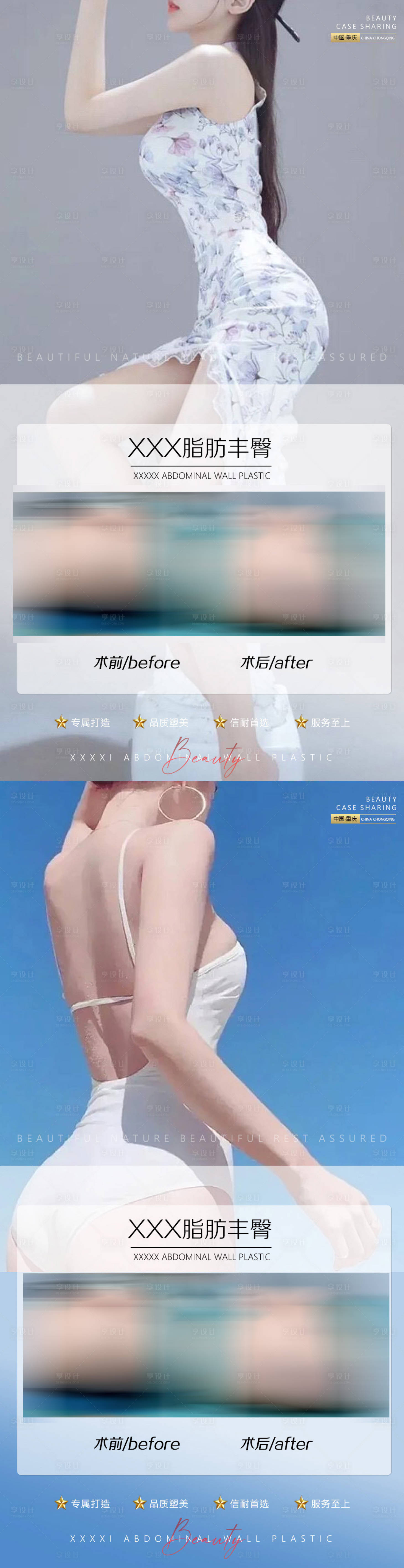 源文件下载【医美案例】编号：77660010365542162