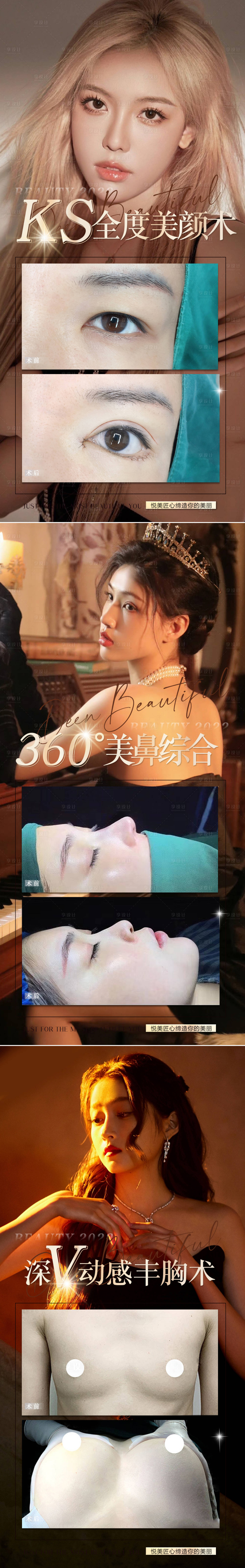 源文件下载【享设计】搜索编号：67870010586647745【医美双眼皮隆鼻案例海报】