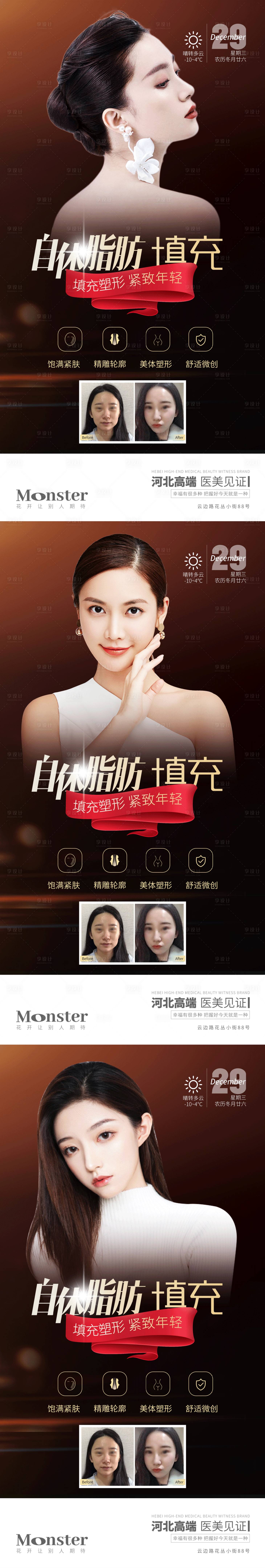 源文件下載【享設(shè)計(jì)】搜索編號(hào)：31920010347099472【脂肪填充醫(yī)美項(xiàng)目系列海報(bào)】