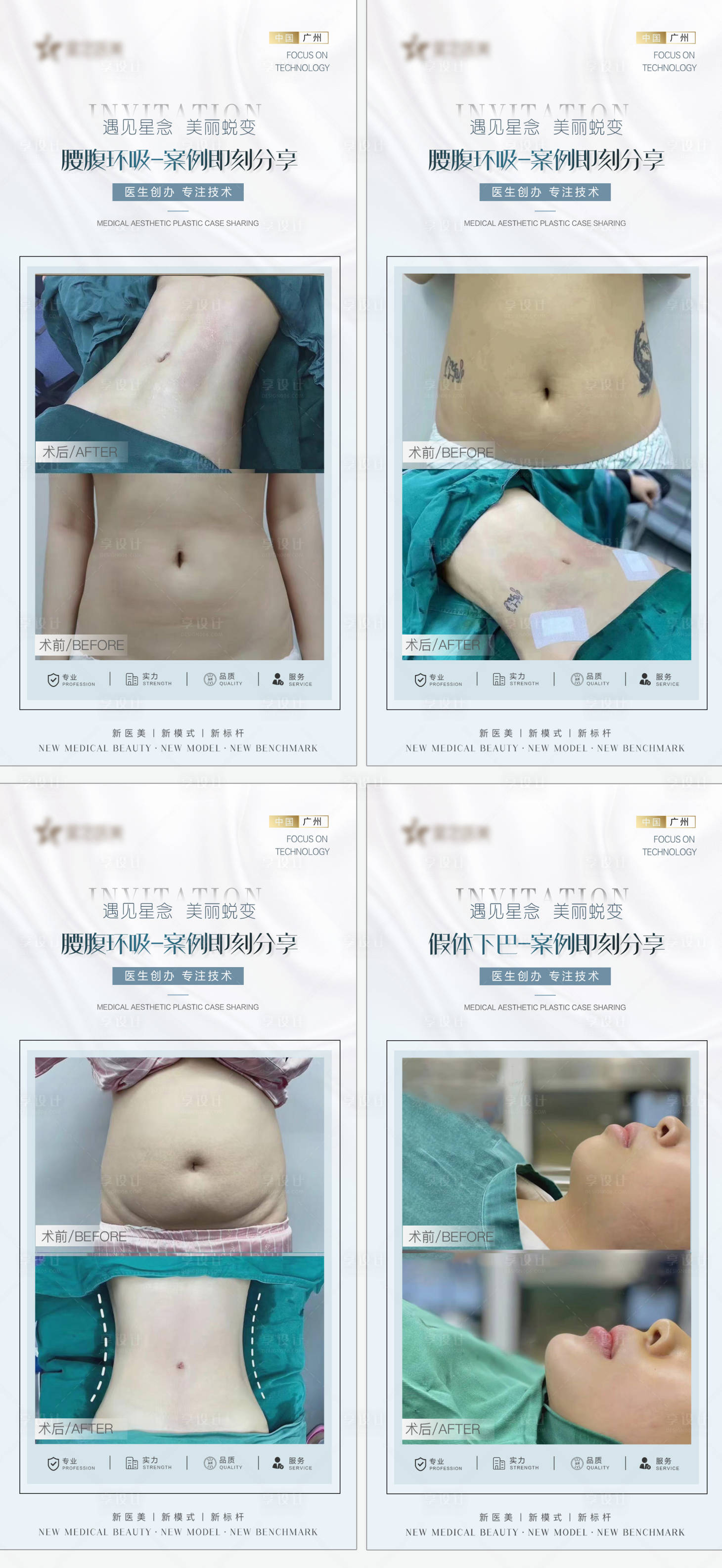 源文件下载【享设计】搜索编号：29720010737489051【医美腰腹环吸案例系列海报】