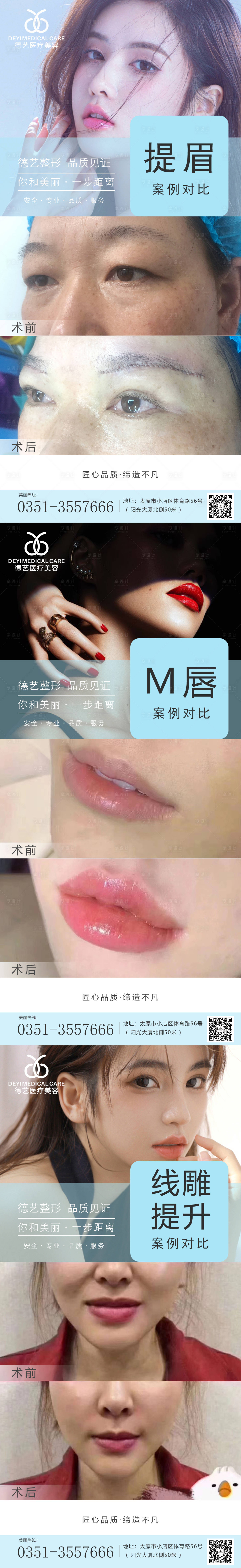 源文件下载【享设计】搜索编号：24150010464979700【医美案例对比系列海报】