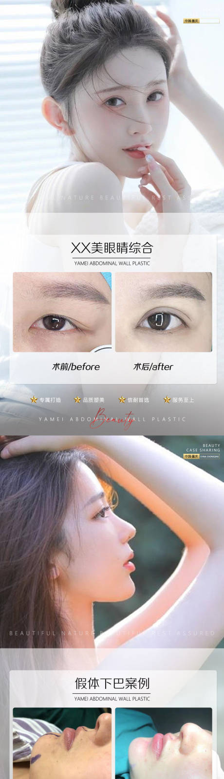 源文件下載【醫美案例海報長圖】編號：64130010326381287