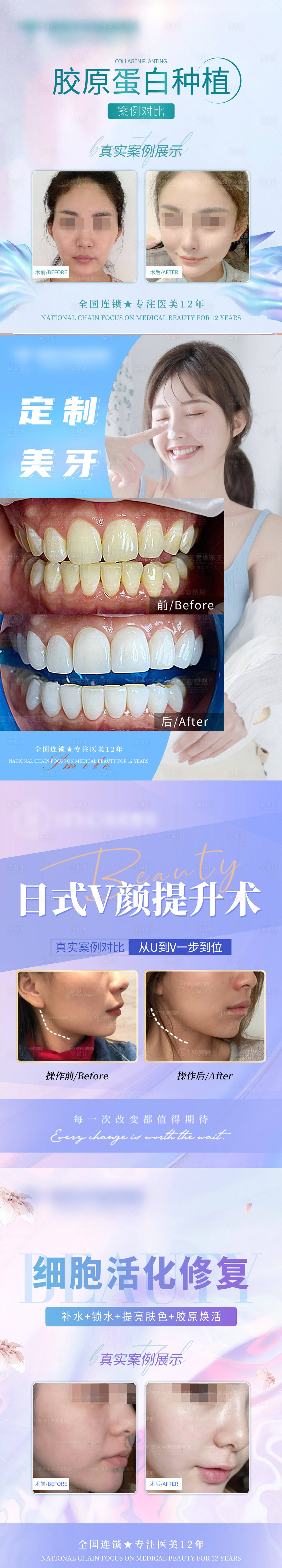 源文件下载【享设计】搜索编号：96390010815027039【医美案例】