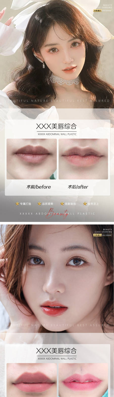 源文件下载【享设计】搜索编号：64030010523032174【医美案例微笑唇唇综合】