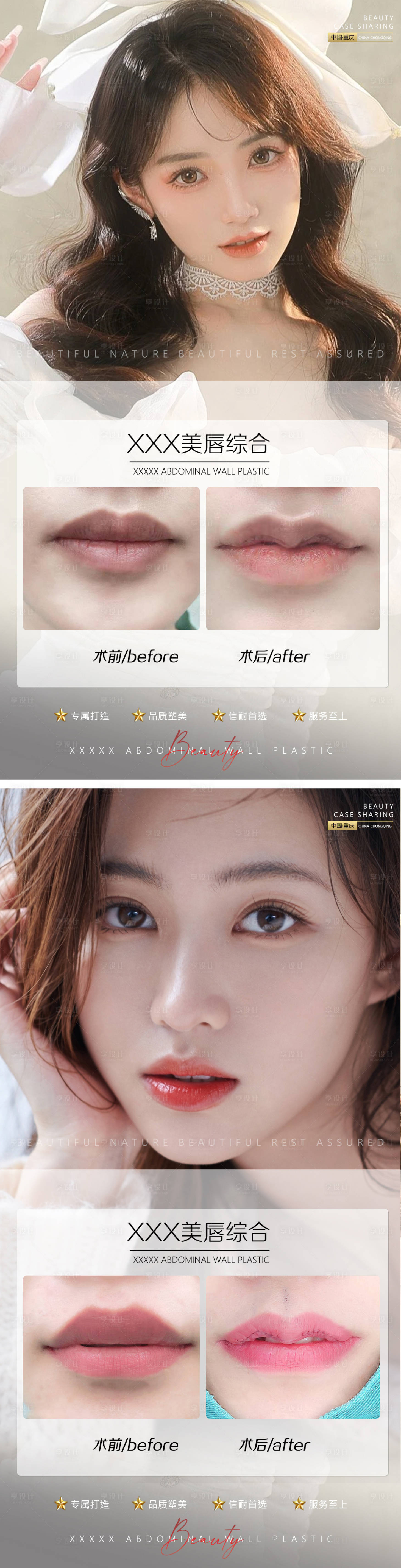 源文件下载【享设计】搜索编号：64030010523032174【医美案例微笑唇唇综合】