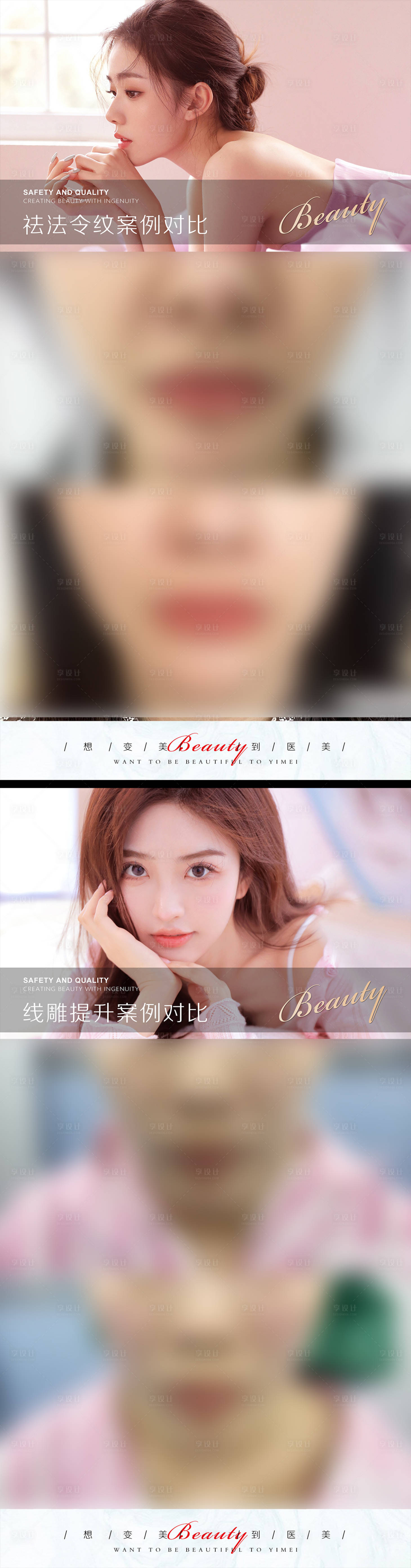 源文件下载【享设计】搜索编号：12320010567912974【医美案例模板系列海报】