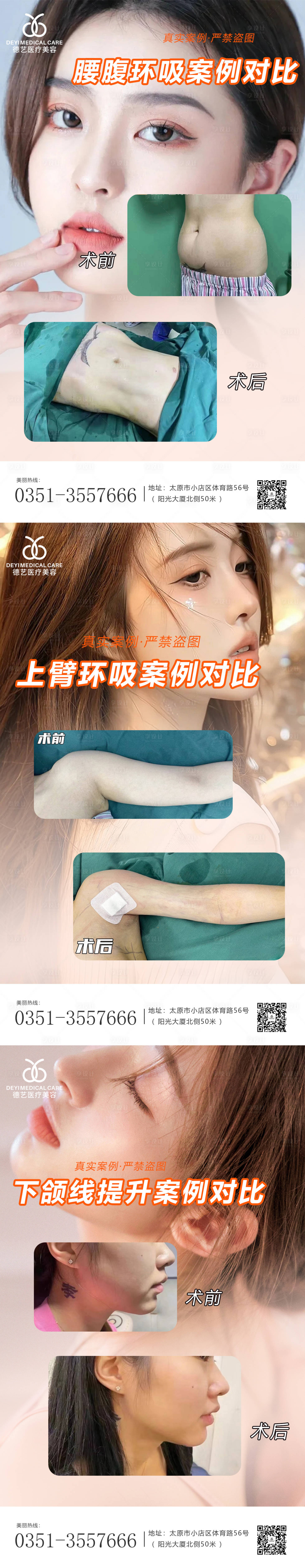 源文件下载【医美案例对比图】编号：28990010480896051