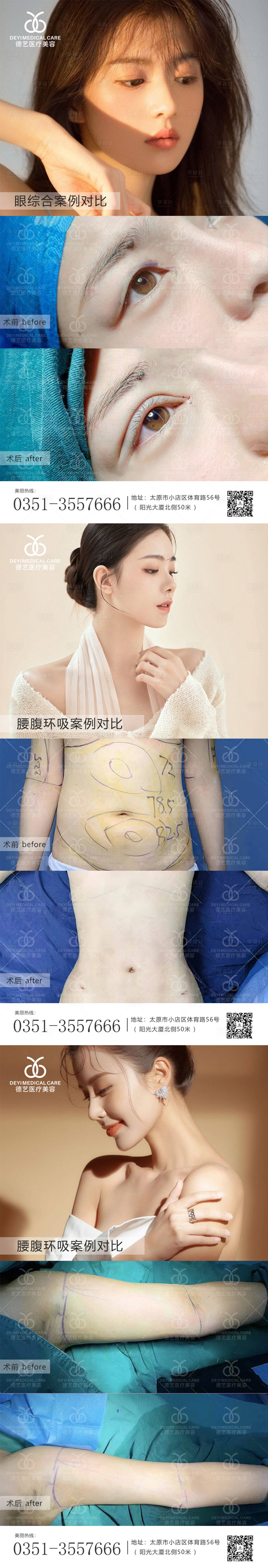 源文件下載【享設計】搜索編號：68660010546363117【醫美案例對比圖】