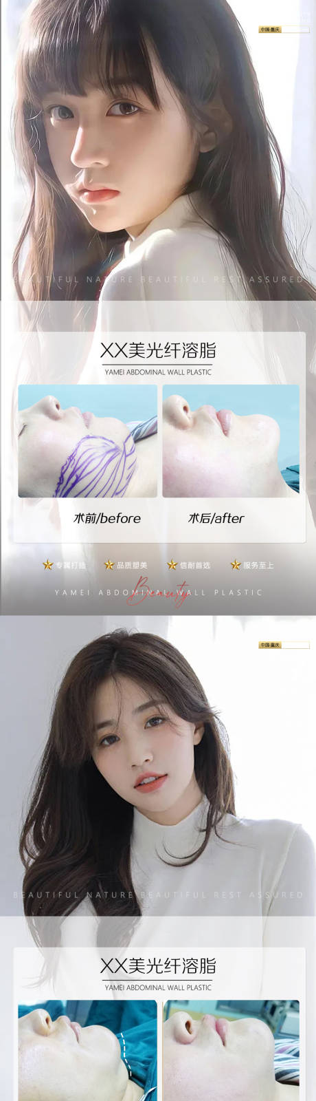 源文件下载【享设计】搜索编号：10340010817153125【光纤溶脂案例海报】