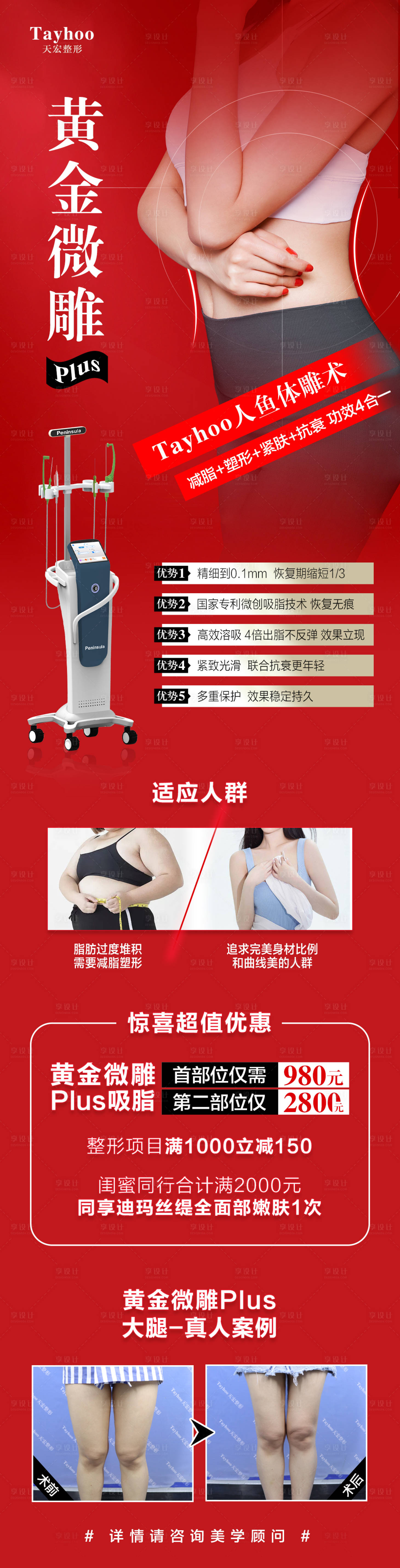 源文件下載【黃金微雕吸脂海報(bào)長(zhǎng)圖】編號(hào)：40290010404035053