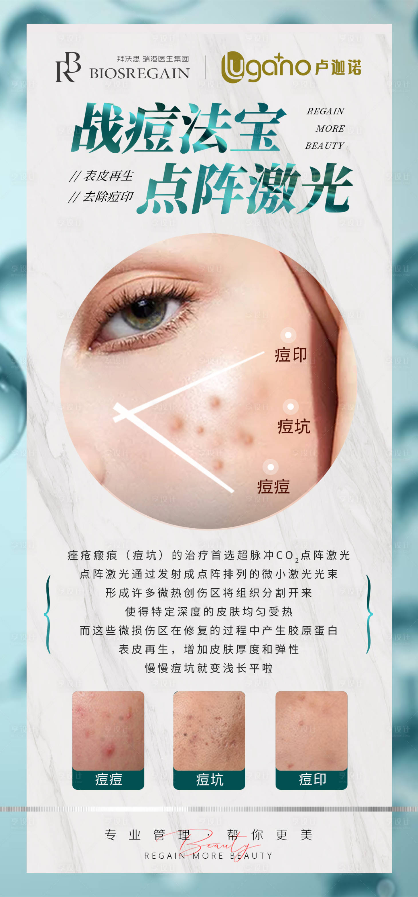 源文件下載【點陣激光】編號：37950010588402820