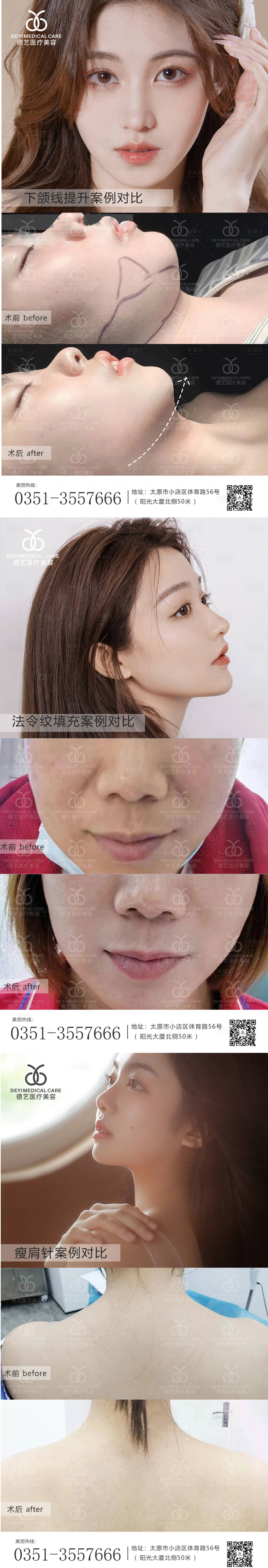 源文件下载【享设计】搜索编号：57960010547246507【医美案例对比图】