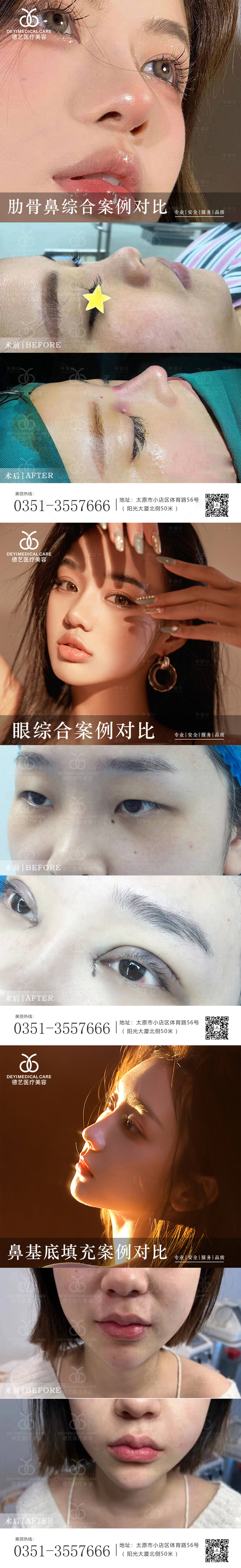 源文件下載【享設計】搜索編號：42620010480344538【醫美案例對比圖】