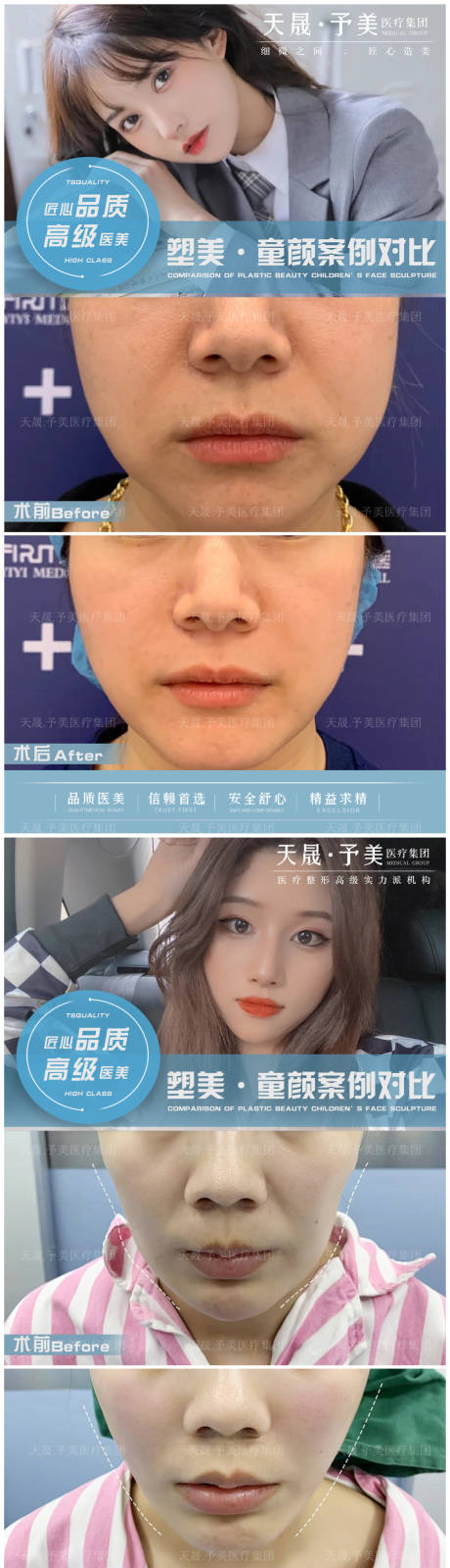 源文件下载【医美案例对比图】编号：78570010488956824