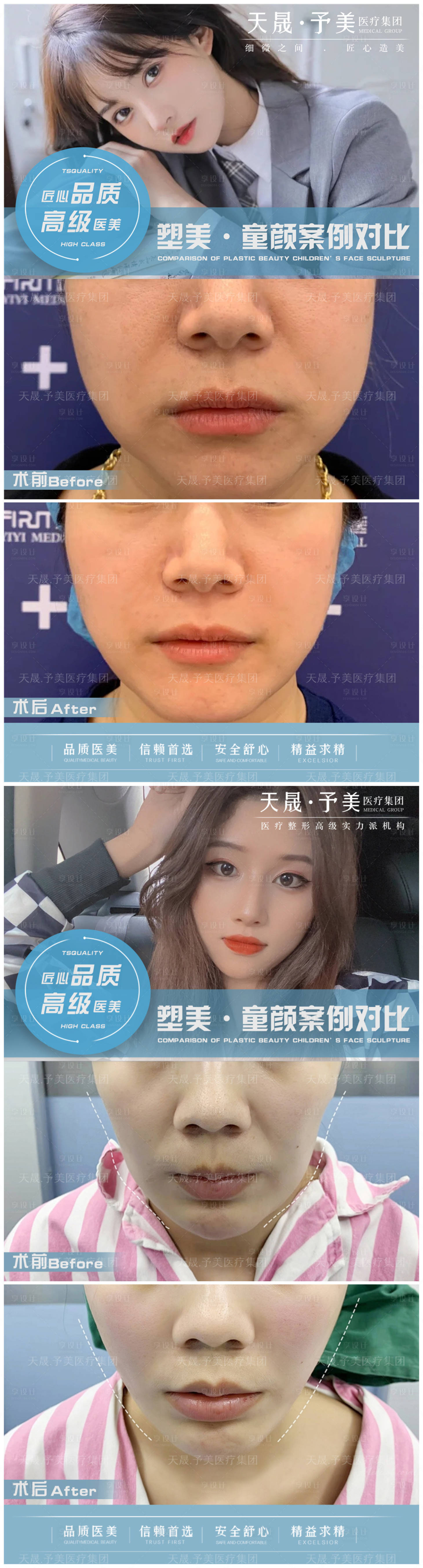 源文件下載【享設計】搜索編號：78570010488956824【醫美案例對比圖】