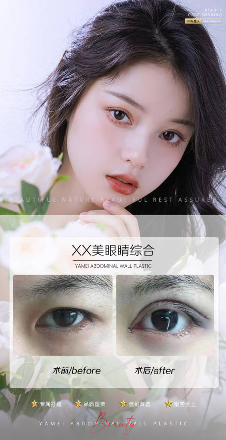 源文件下载【医美案例眼睛】编号：48490010521871963
