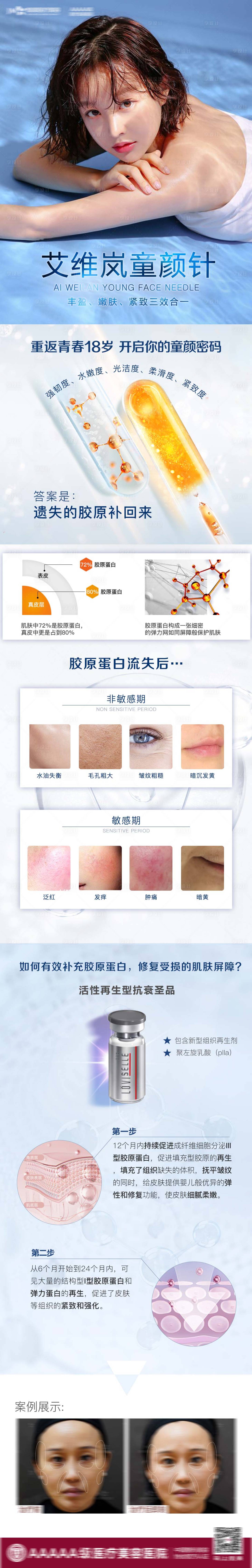 源文件下載【享設(shè)計】搜索編號：80480010490631664【醫(yī)美艾維嵐童顏針長圖】