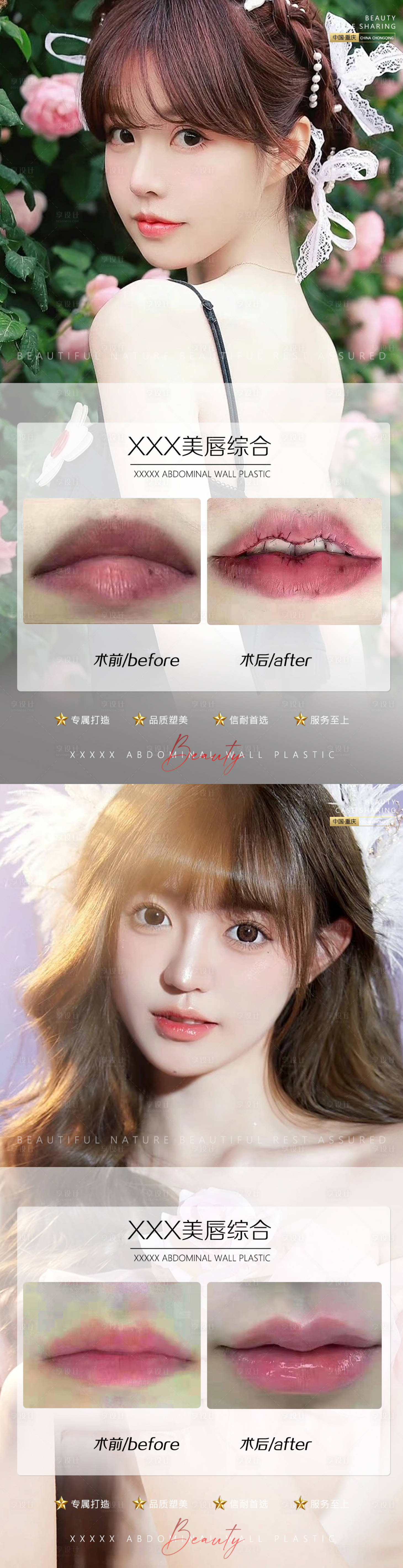 源文件下載【醫(yī)美案例長(zhǎng)圖】編號(hào)：95970010809483488