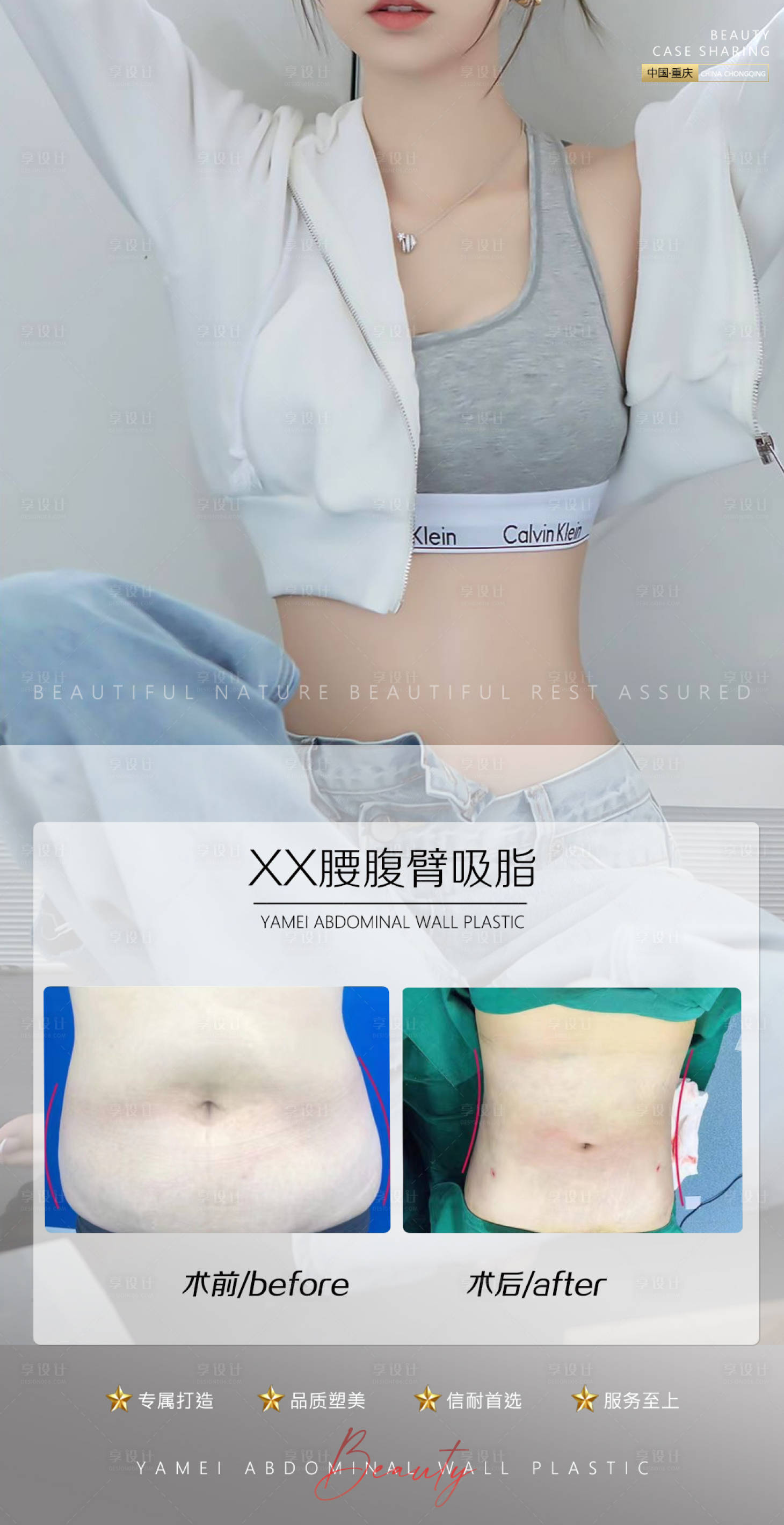 源文件下载【享设计】搜索编号：49970010568172304【医美案例腰腹吸脂海报】