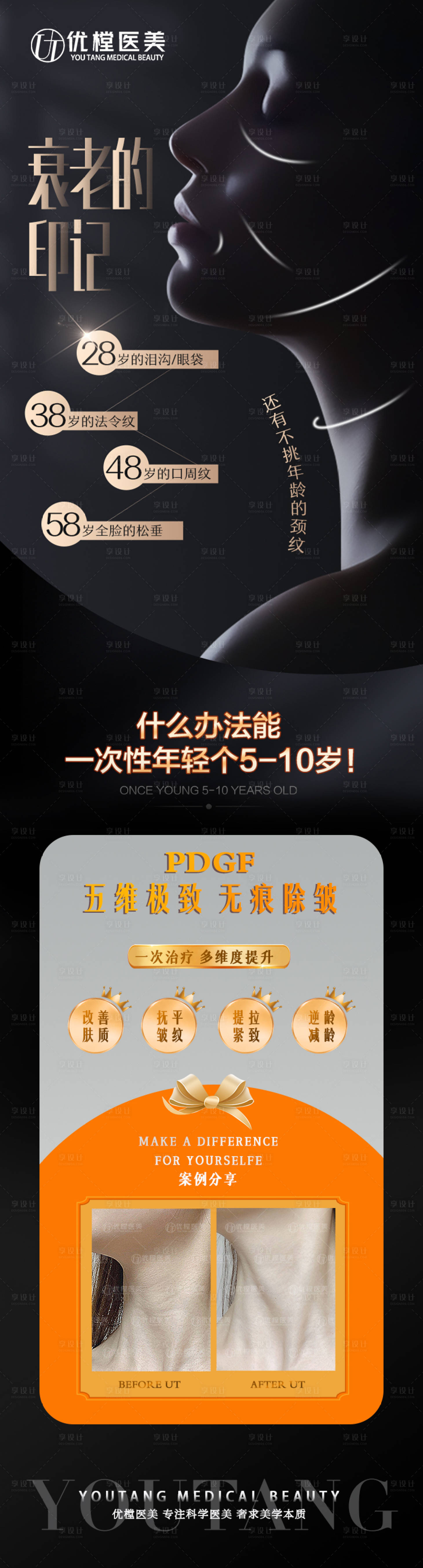 源文件下載【享設(shè)計(jì)】搜索編號(hào)：75390010543978966【醫(yī)美除皺黑金長(zhǎng)圖海報(bào)】