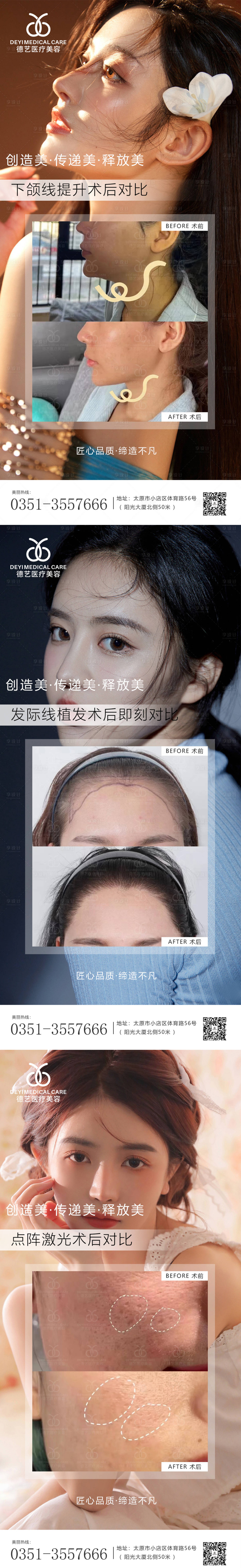 源文件下載【享設(shè)計】搜索編號：45870010744259562【醫(yī)美案例對比圖系列海報】