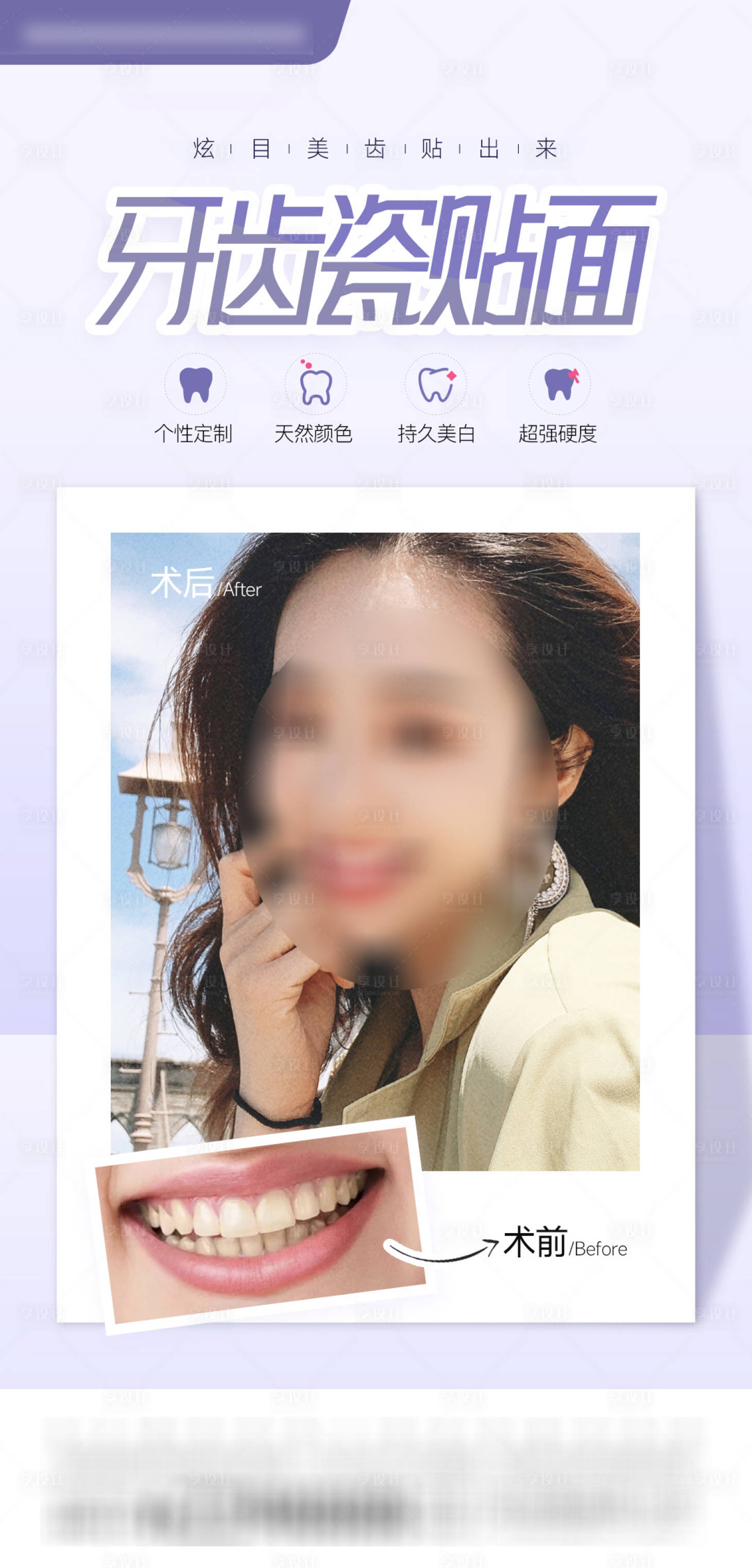 源文件下載【享設(shè)計】搜索編號：72150010372499250【牙齒瓷貼面口腔海報】