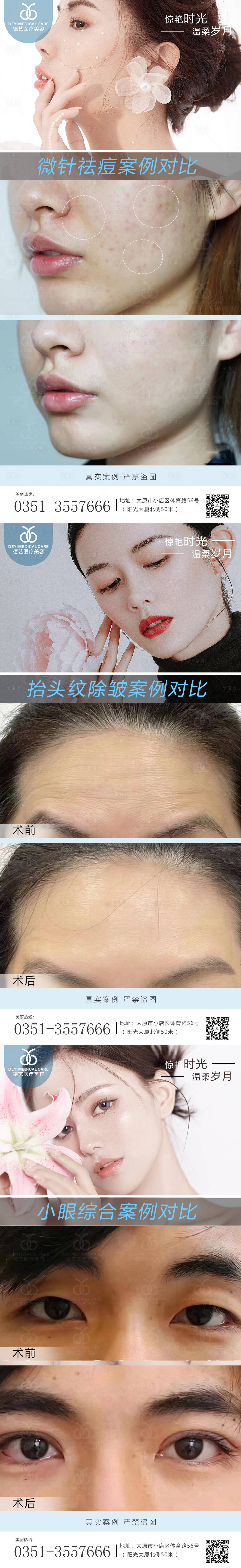 源文件下載【享設(shè)計(jì)】搜索編號(hào)：27110010753595853【醫(yī)美案例對(duì)比圖】
