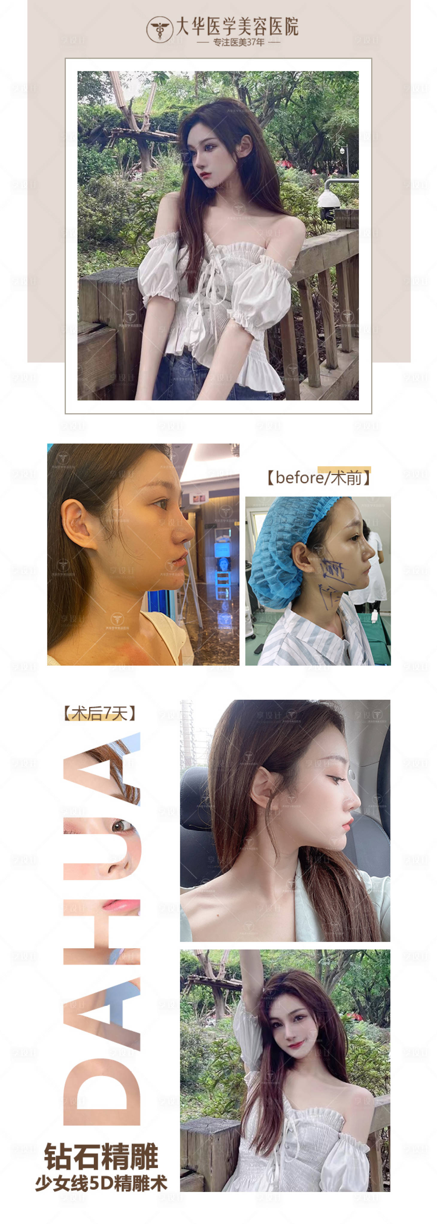 源文件下载【医美案例】编号：66860010944256236