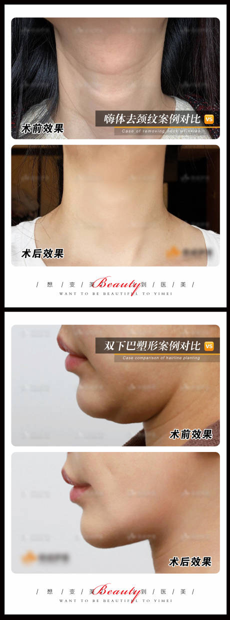 源文件下载【享设计】搜索编号：28040010916858822【医美案例模板系列海报】