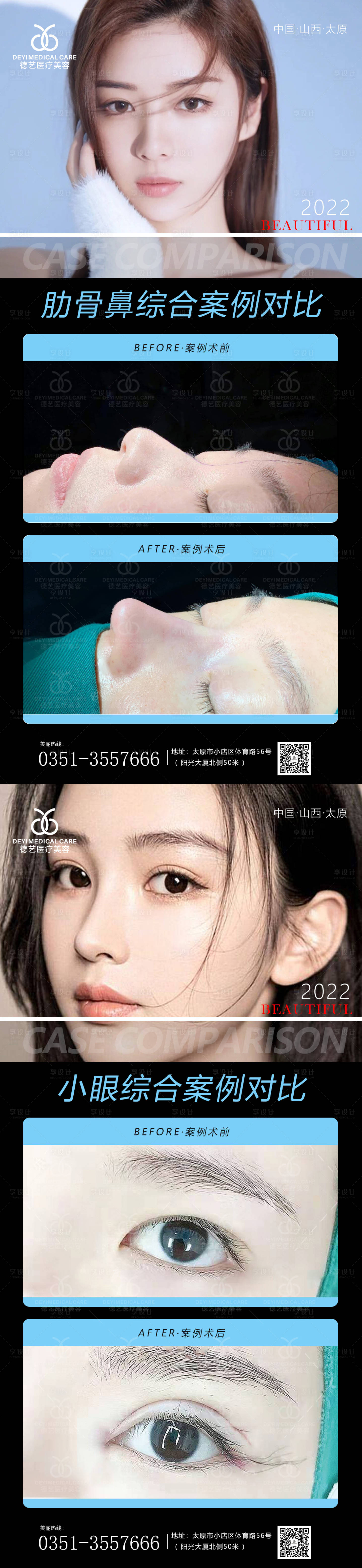 源文件下载【享设计】搜索编号：15900011366727010【医美案例对比图】