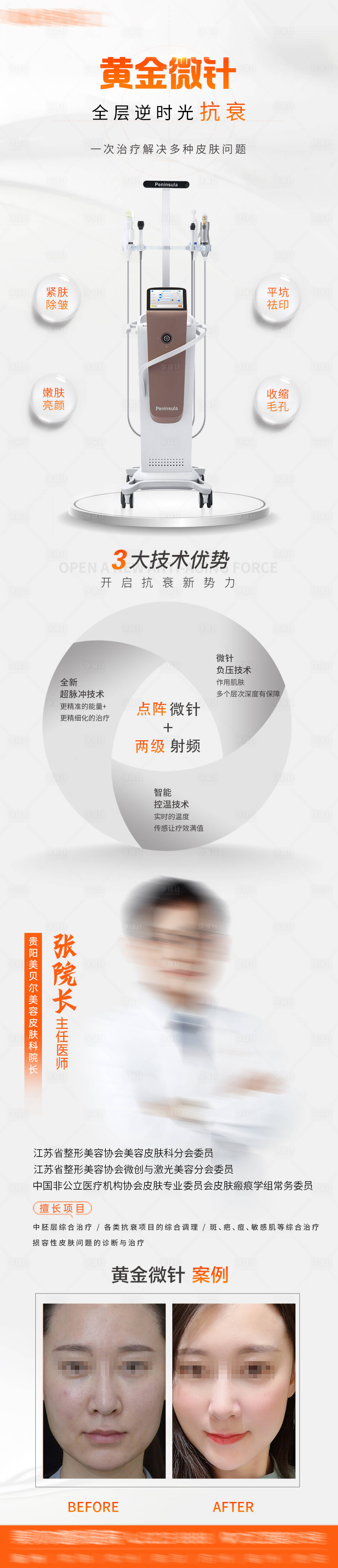 源文件下載【享設計】搜索編號：64970011260266506【黃金微針詳情頁】