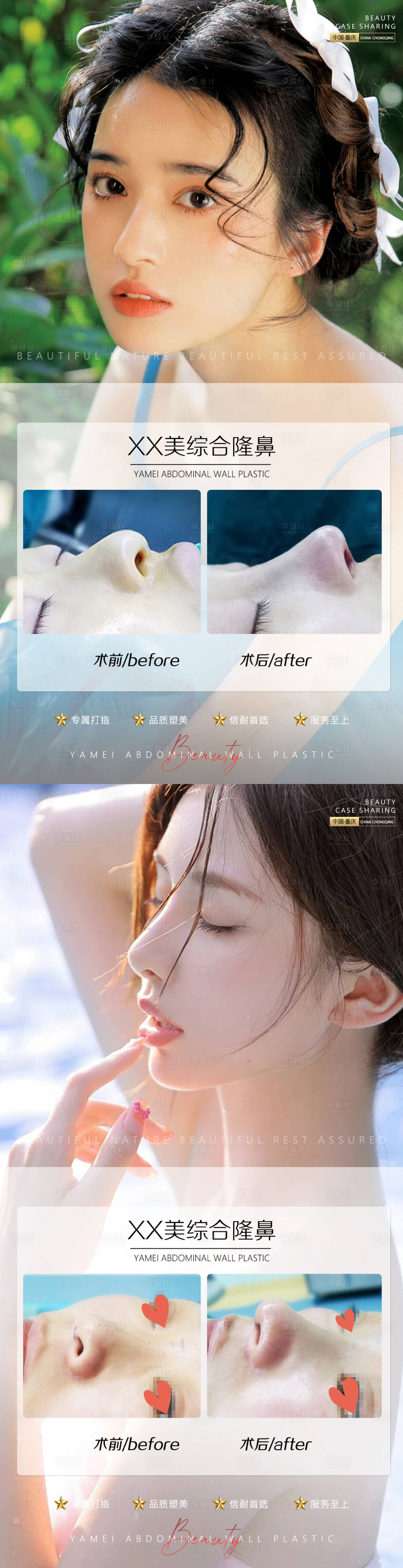 源文件下载【医美案例鼻子】编号：99870011178325719