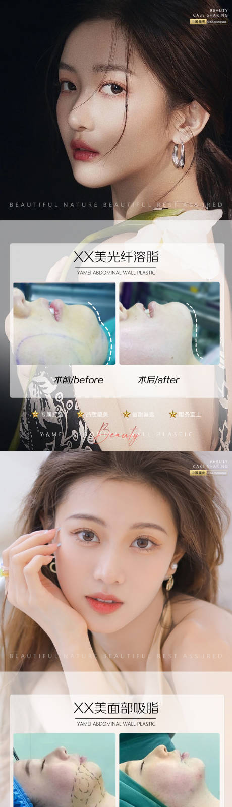 源文件下载【医美案例光纤溶脂】编号：31850011102144569