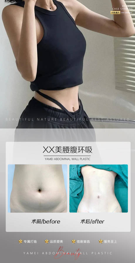 源文件下载【医美案例腰腹环吸海报】编号：99410011037607083