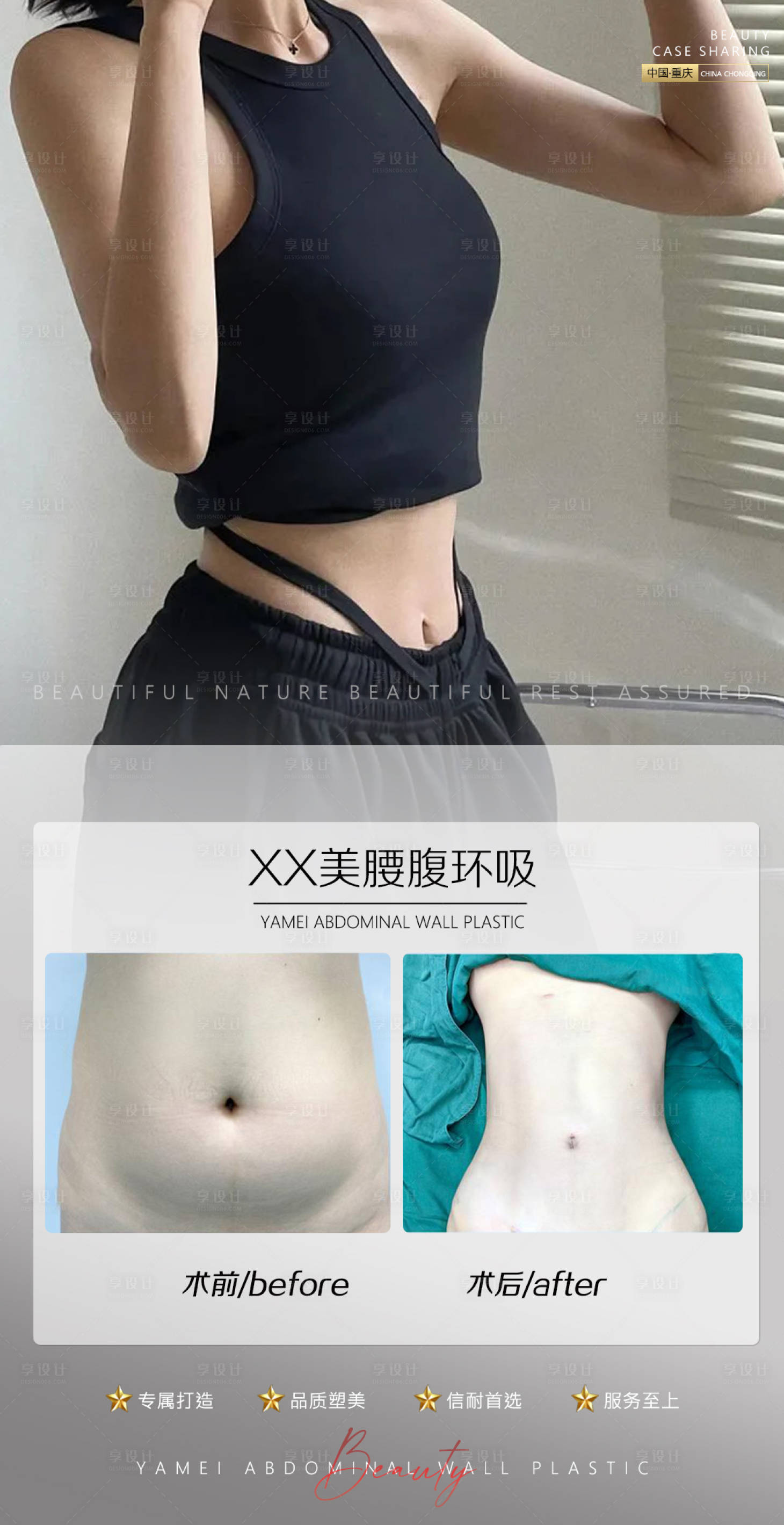 源文件下载【享设计】搜索编号：99410011037607083【医美案例腰腹环吸海报】